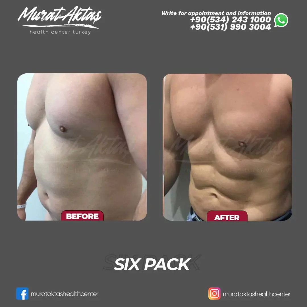 Six Pack