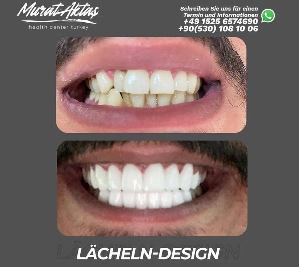 Dental39