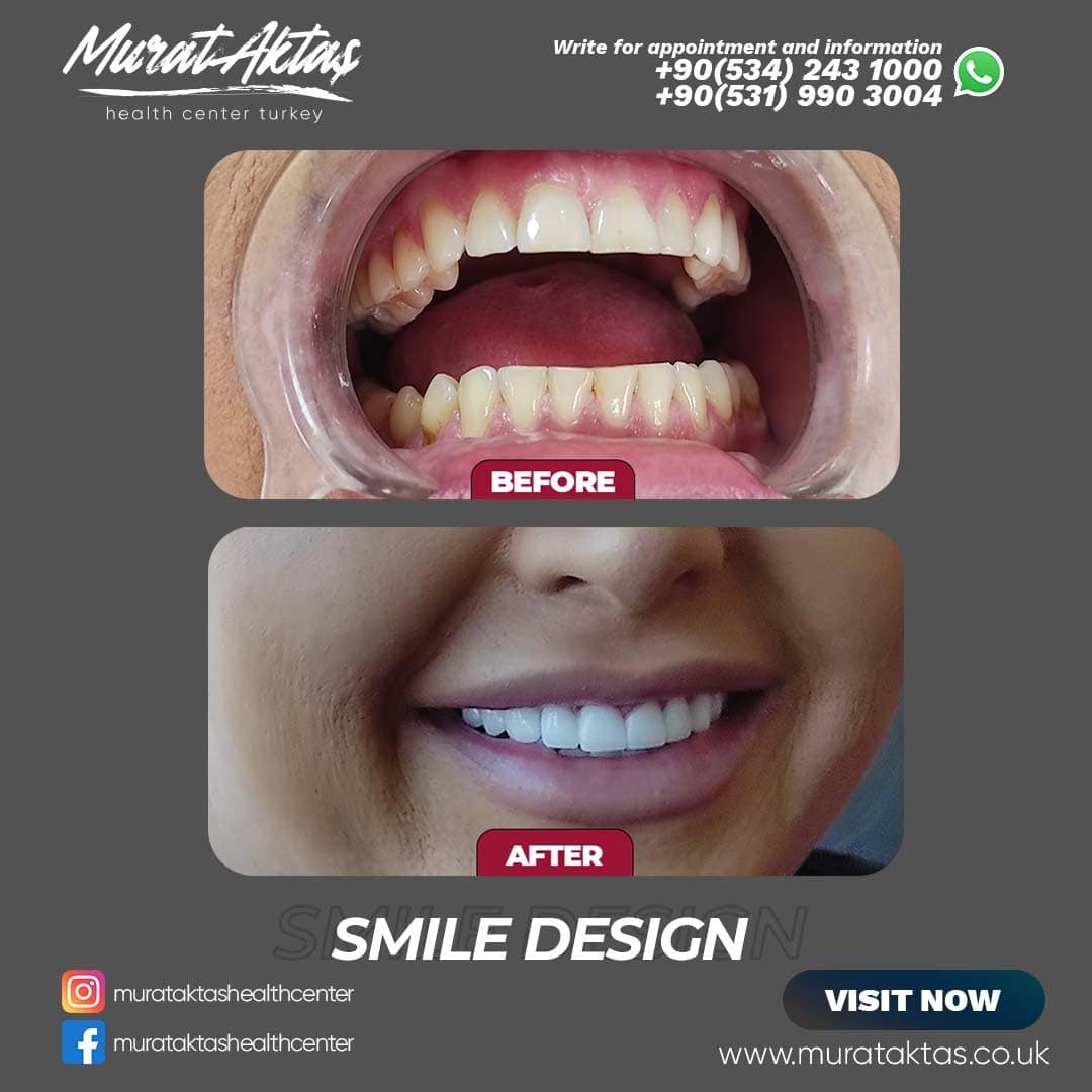 Dental52