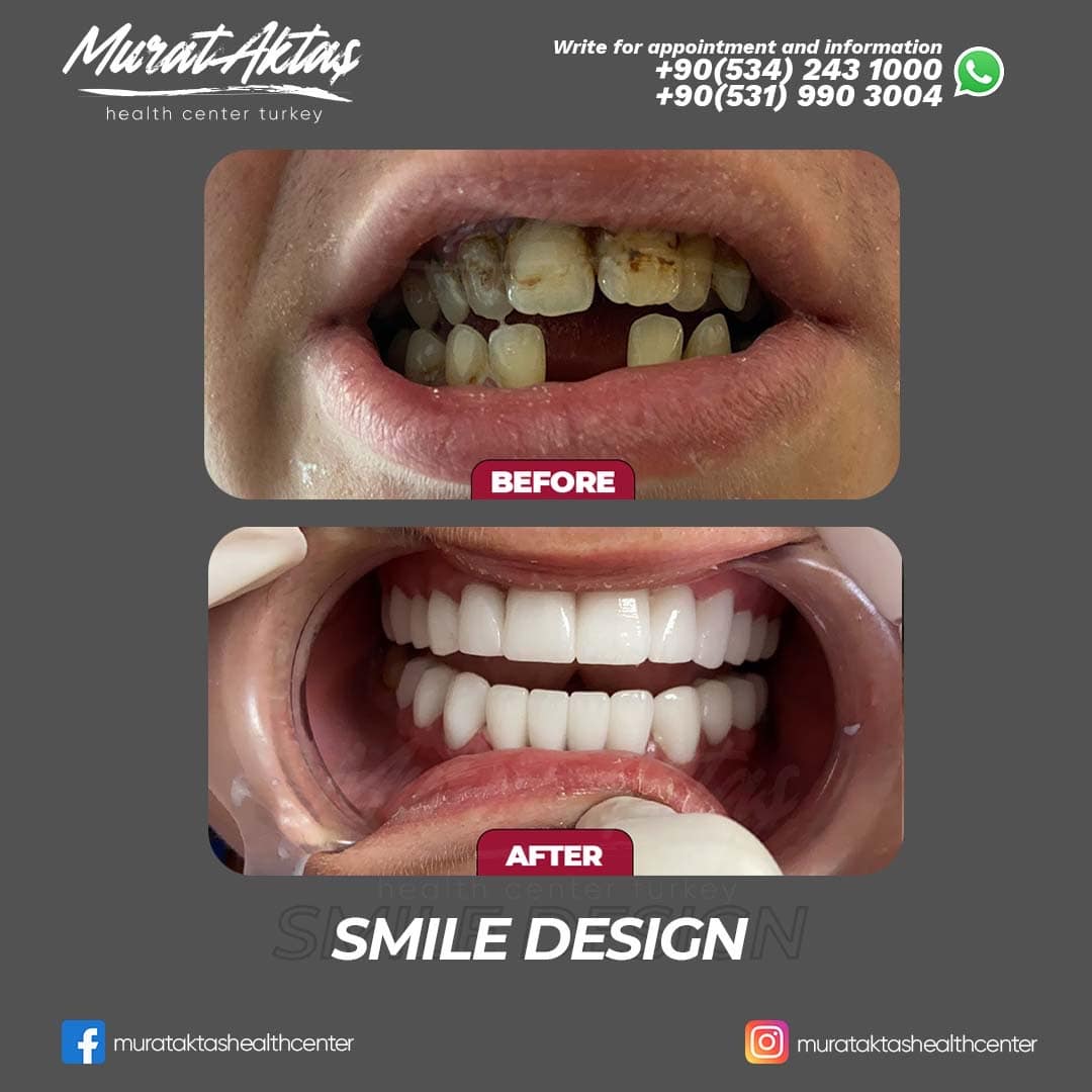 Dental61