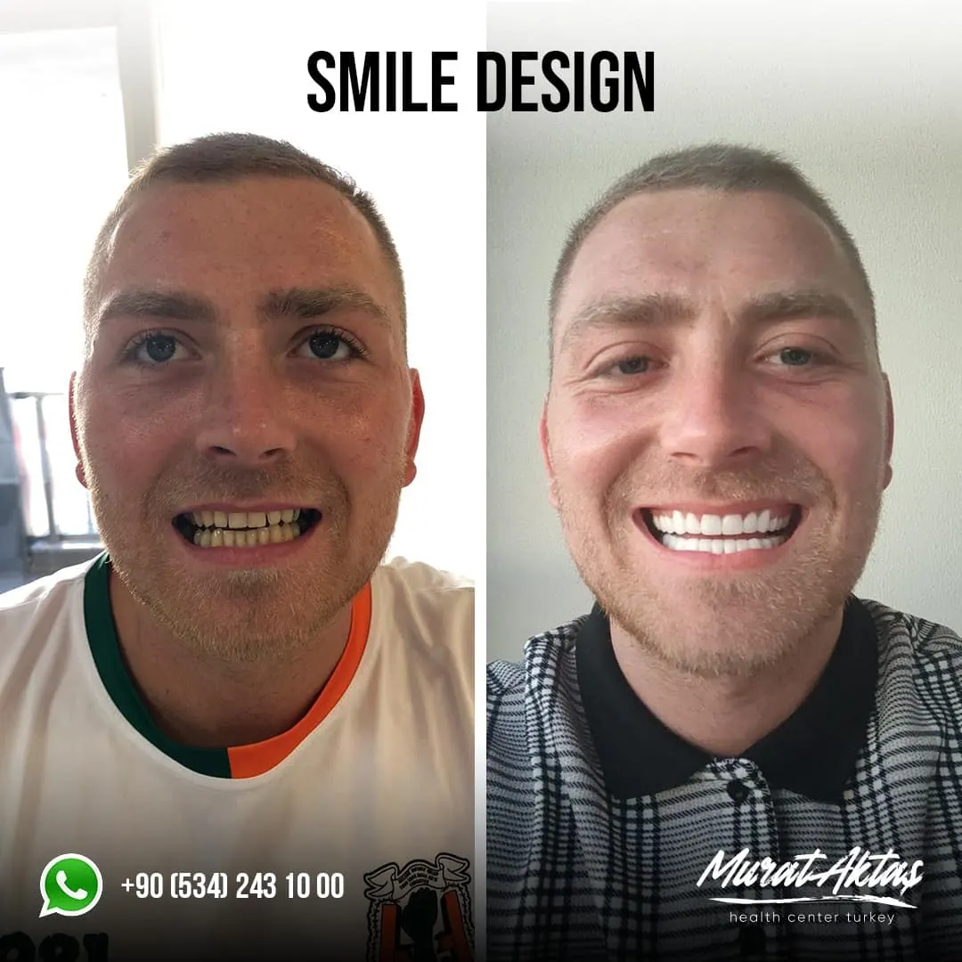 Dental35