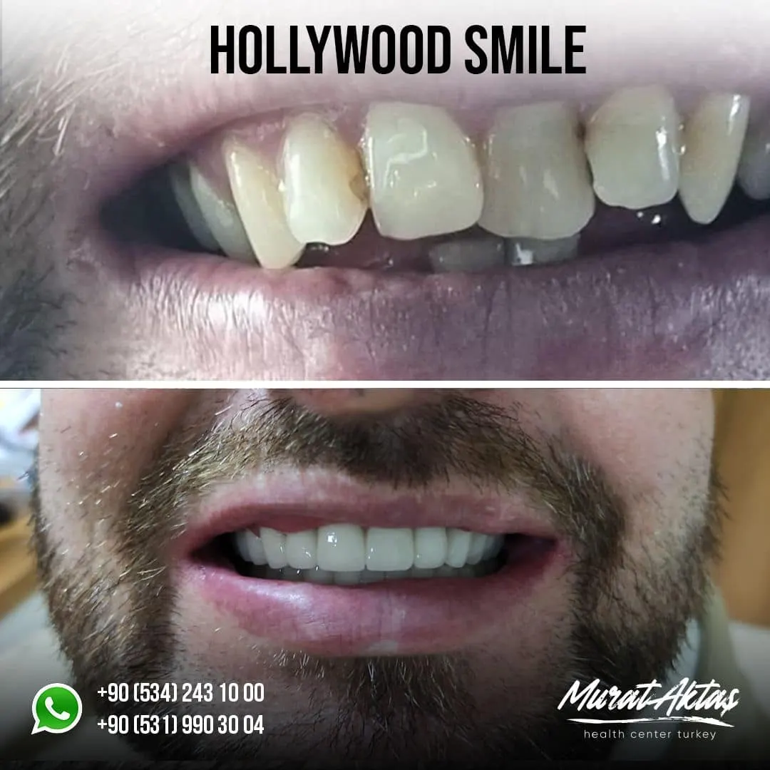 Dental45