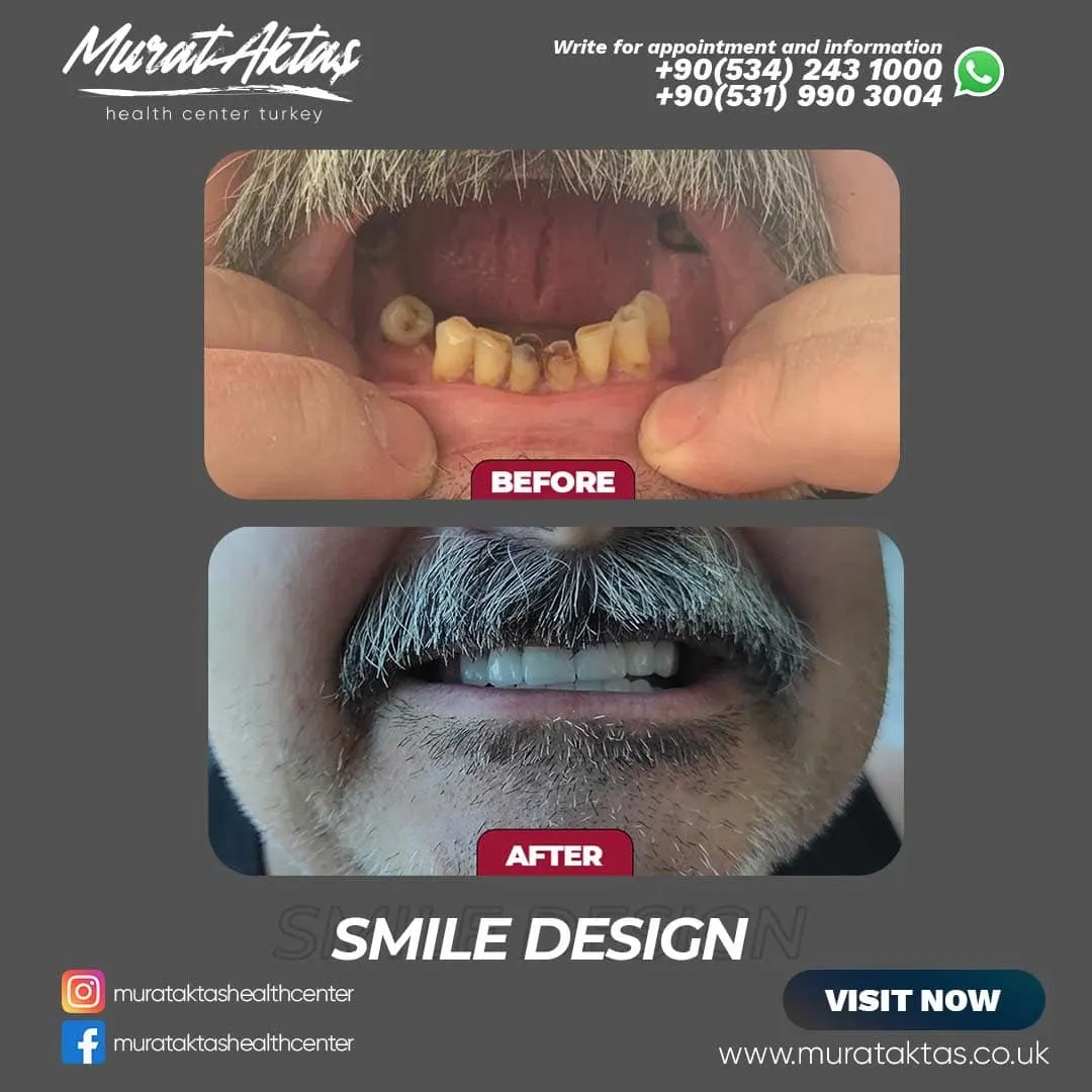 Dental51